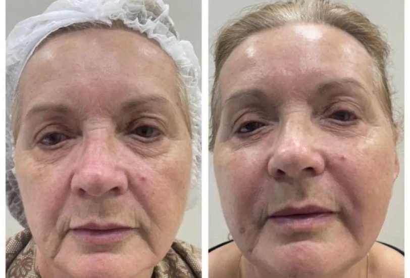 Anti-Aging Treatments