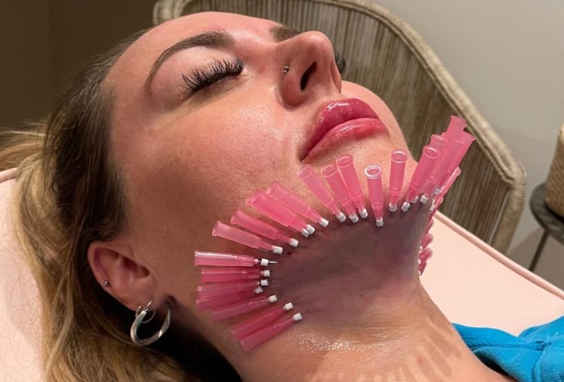 Facial Contouring & Lifting