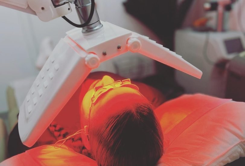 Laser Hair Removal