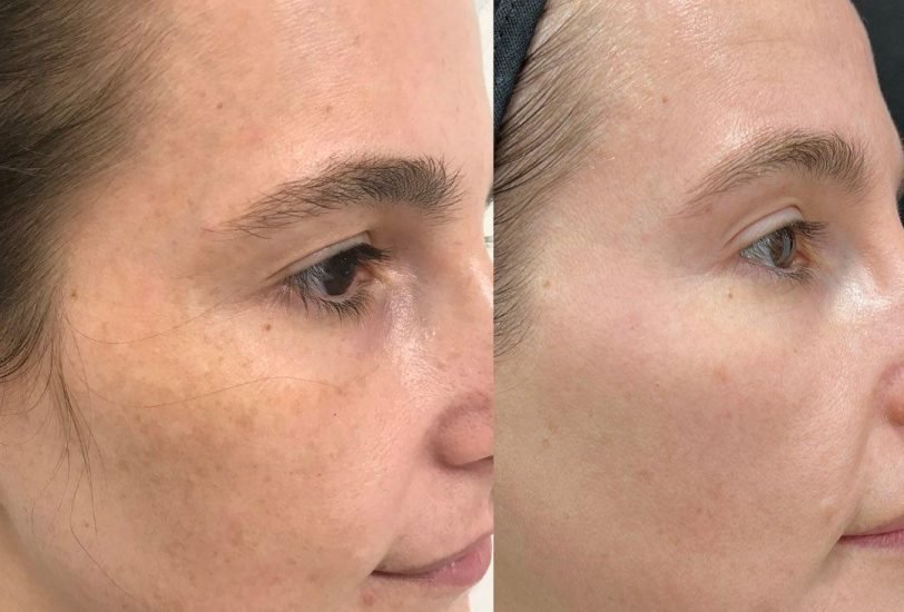 Anti-Aging Treatments