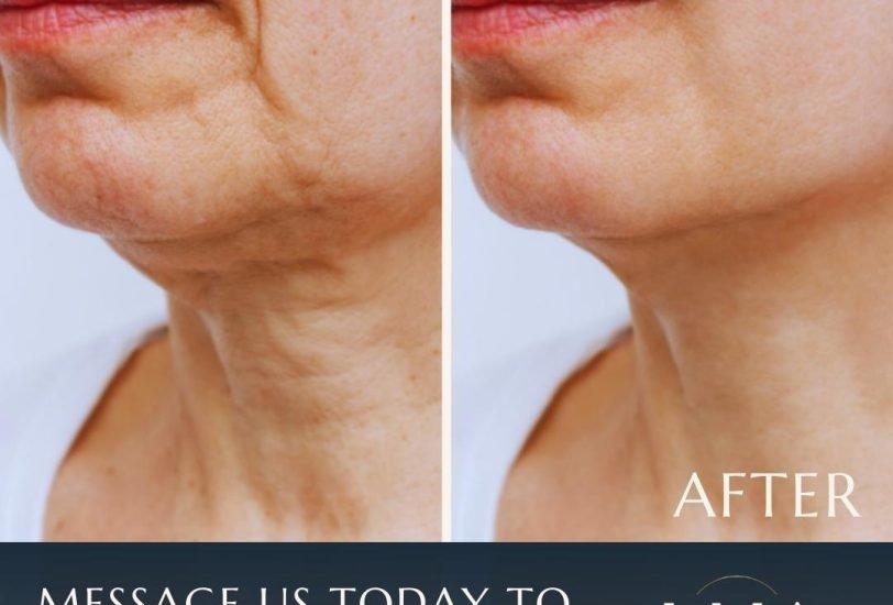 Anti-Aging Treatments