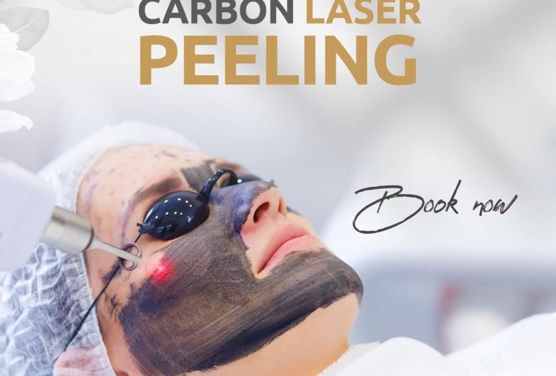 Laser Hair Removal