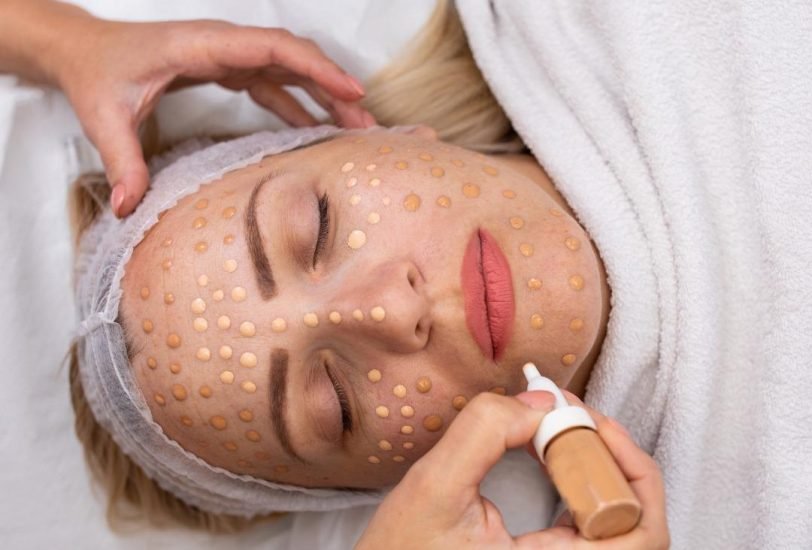 Pigmentation & Skin Tone Correction
