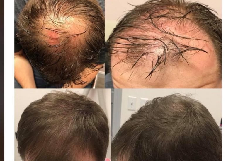 Hair Treatments
