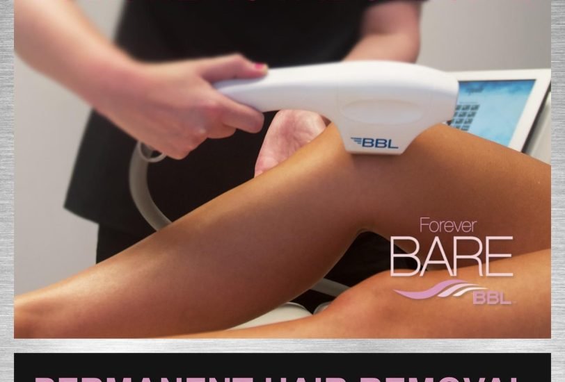Laser Hair Removal