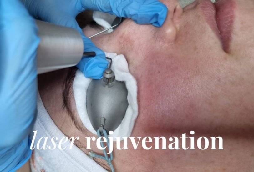 Anti-Aging Treatments
