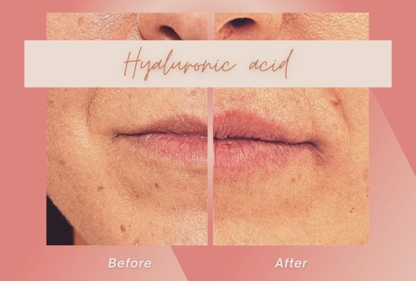 Lips Treatments