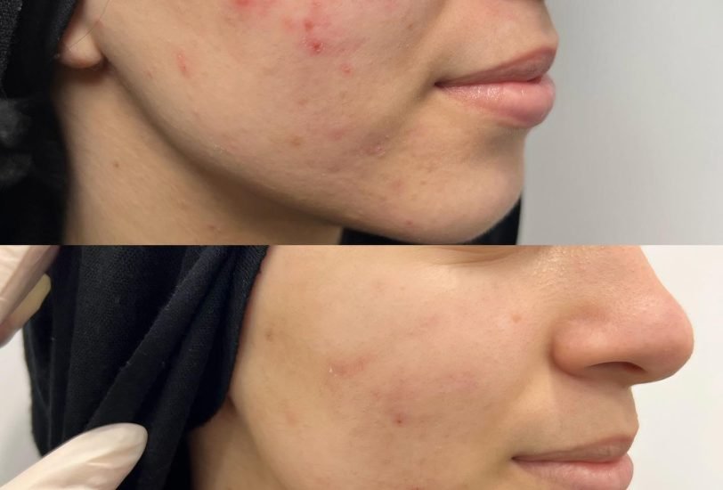 Injectable Treatments