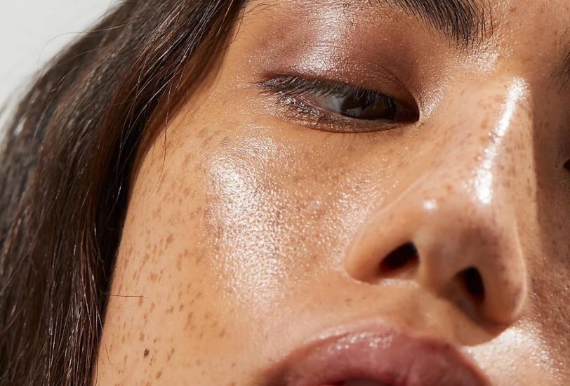 Acne & Scar Treatments