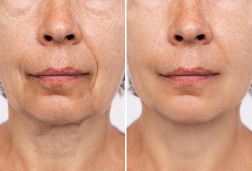 Anti-Aging Treatments