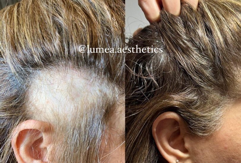 Hair Treatments