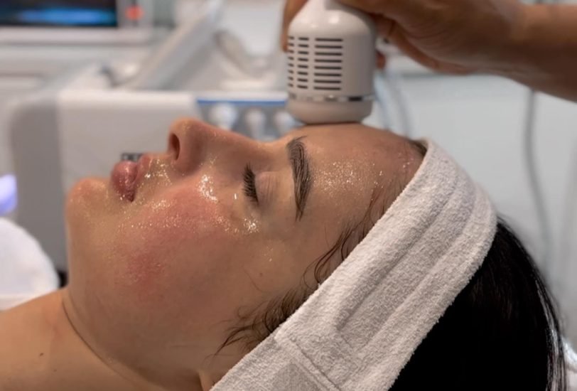 Vein Treatments