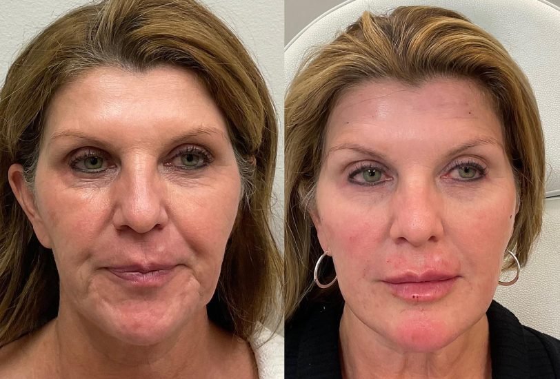 Anti-Aging Treatments