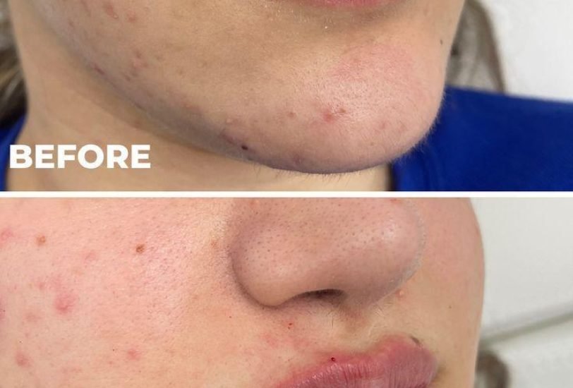 Injectable Treatments