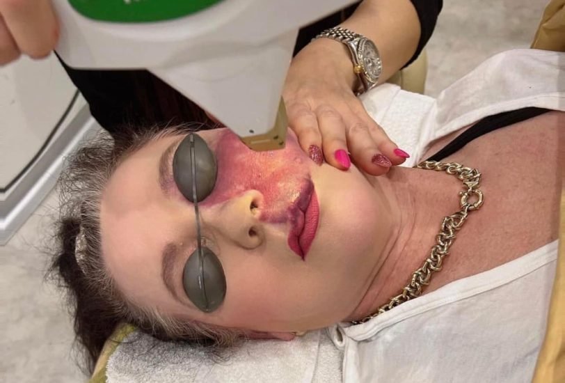 Pigmentation & Skin Tone Correction