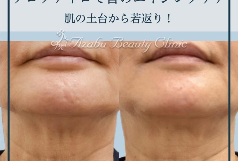 Anti-Aging Treatments