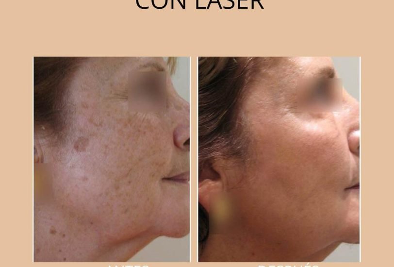 Anti-Aging Treatments