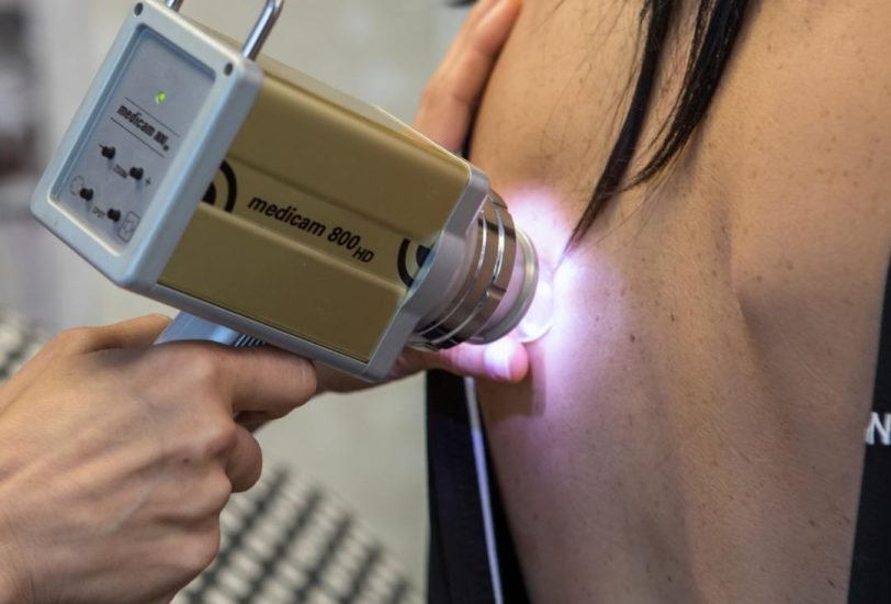 Laser & Light Therapies