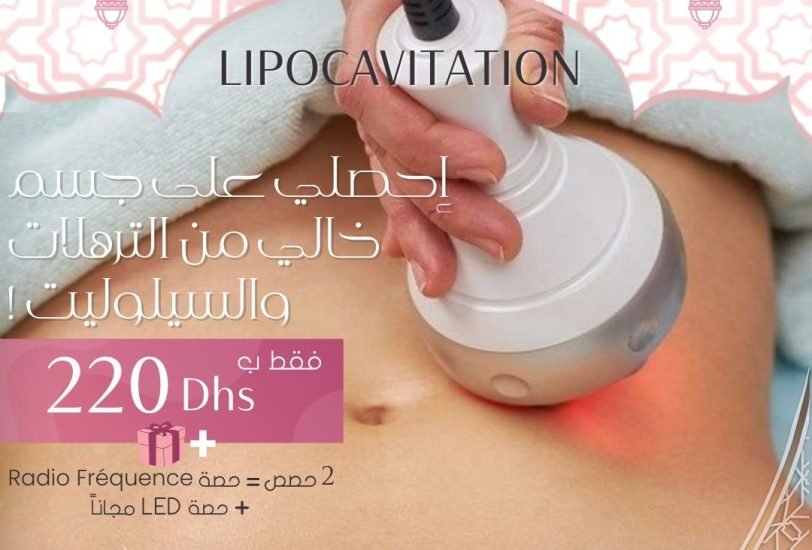 Skin Tightening
