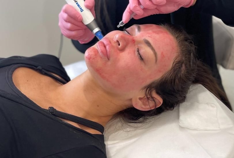Injectable Treatments