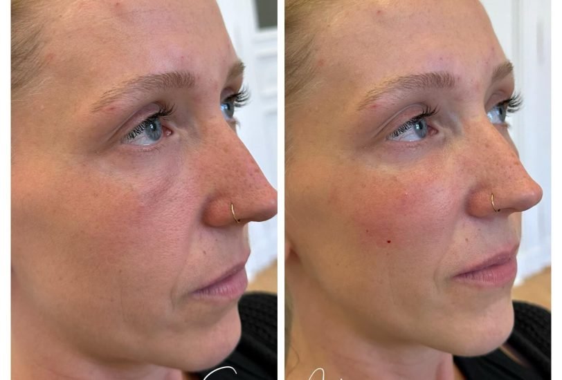Anti-Aging Treatments