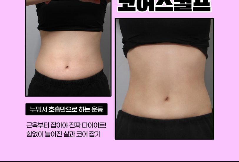 Body Contouring