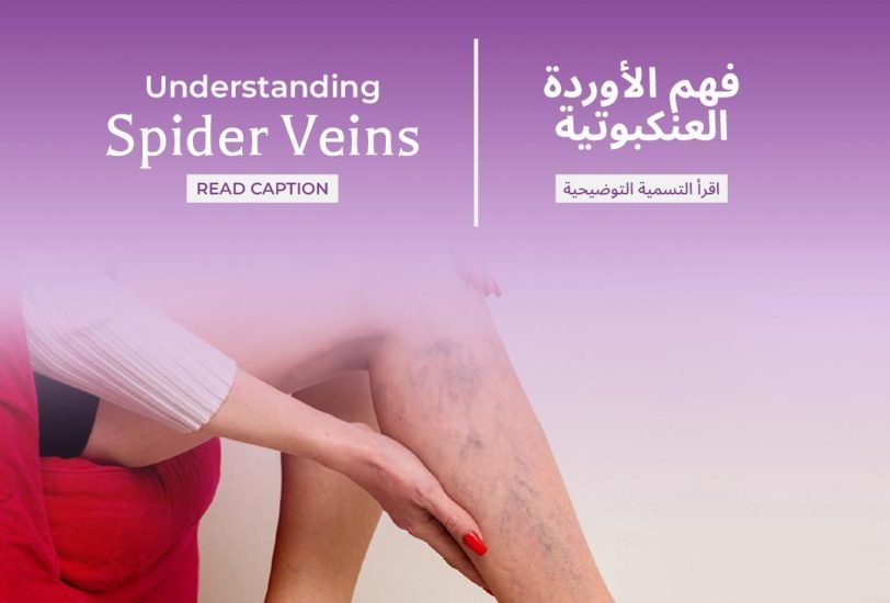 Vein Treatments