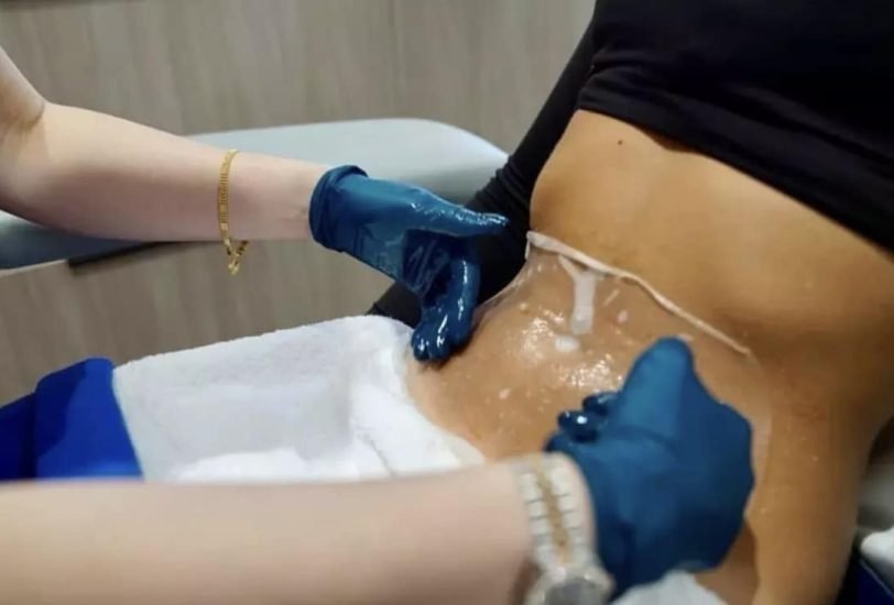 Body Contouring