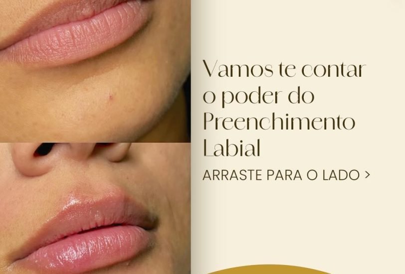 Lips Treatments