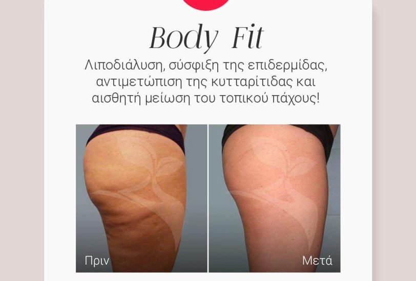 Cellulite Reduction