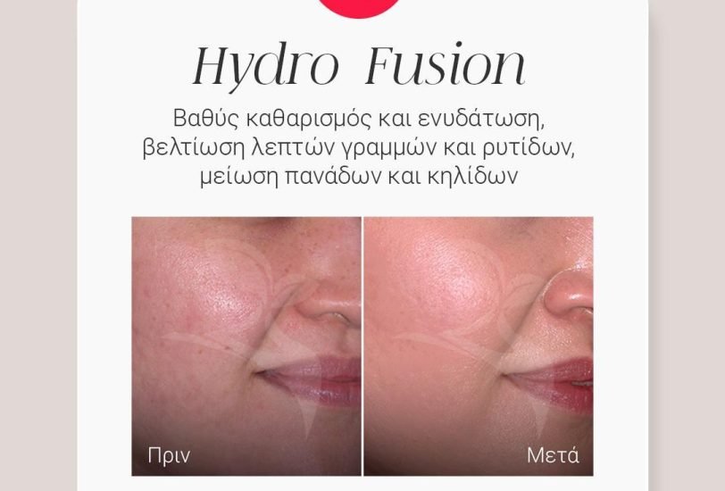 Acne & Scar Treatments