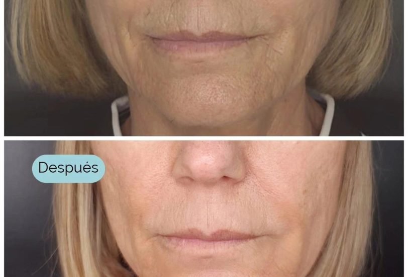 Anti-Aging Treatments