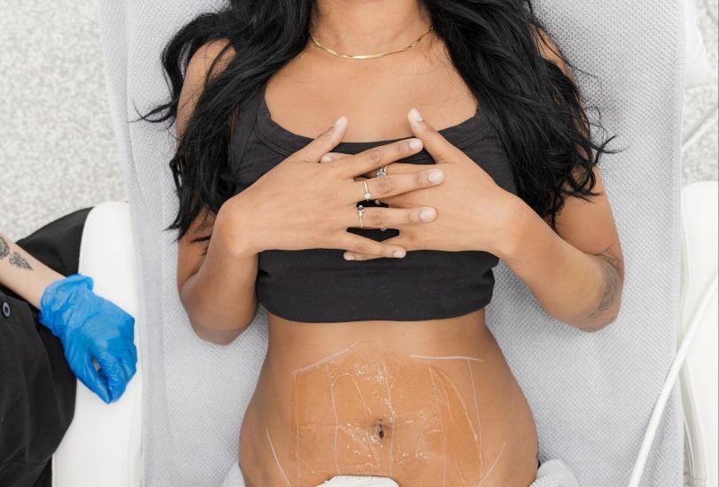 Body Contouring