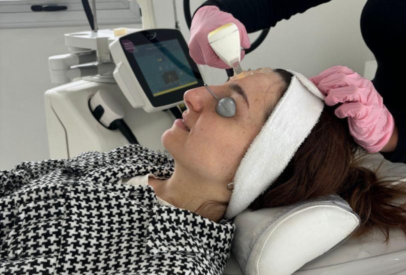Laser Hair Removal