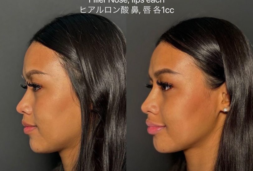 Pigmentation & Skin Tone Correction