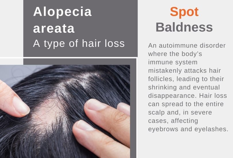 Hair Treatments