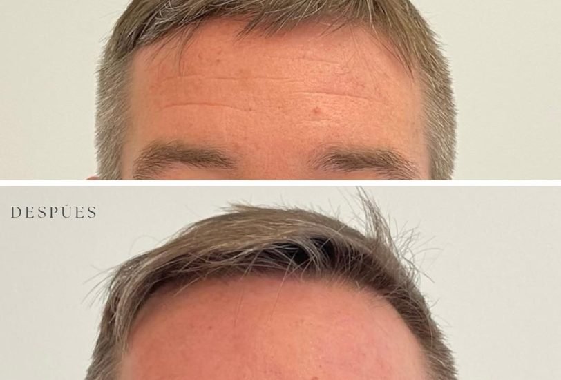 Hair Treatments