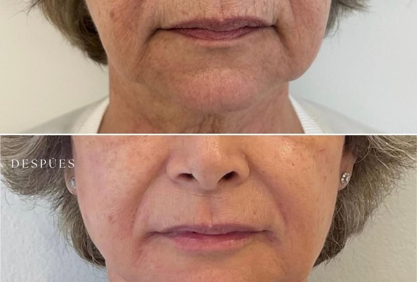 Anti-Aging Treatments