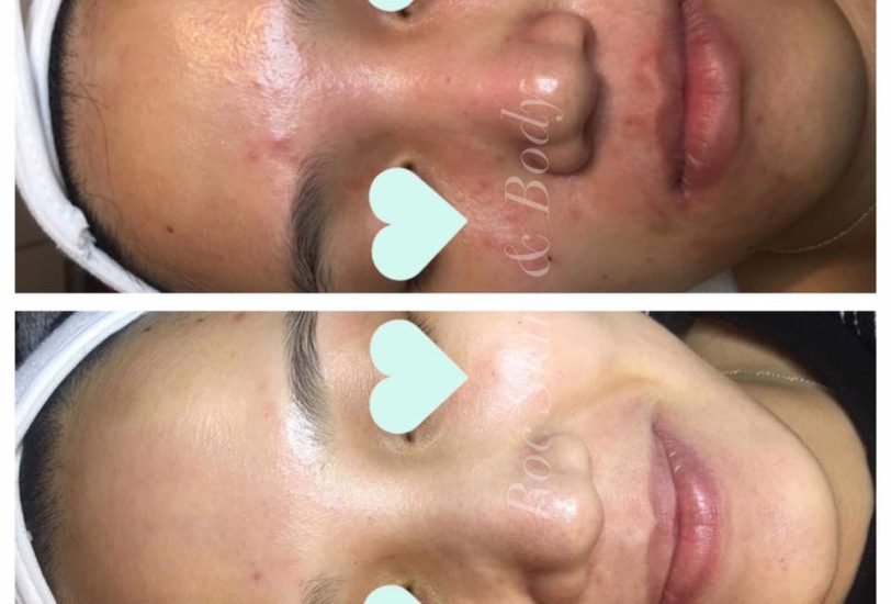 Anti-Aging Treatments