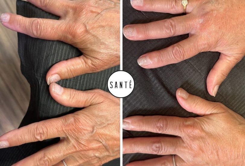 Anti-Aging Treatments