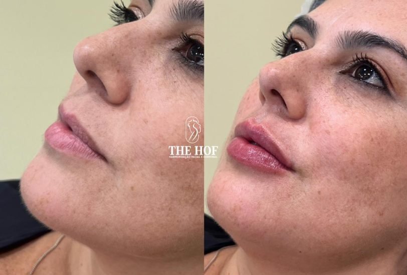 The Hof Clinic 3 – VerifiedCare Injectable Treatments