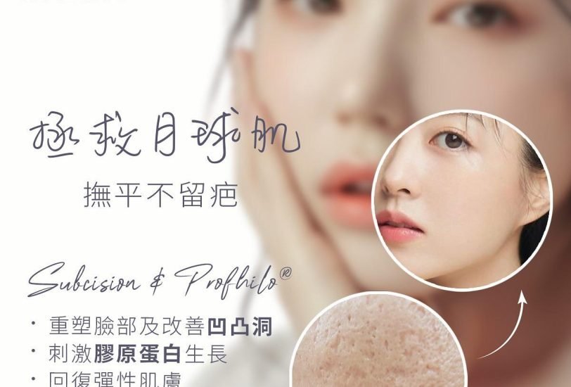 Acne & Scar Treatments