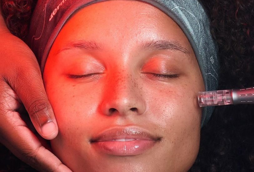 Laser & Light Therapies
