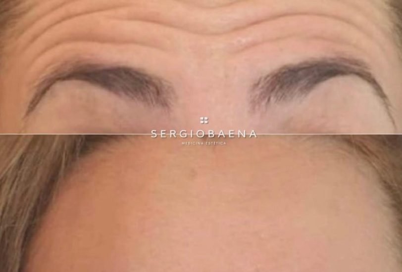 Anti-Aging Treatments
