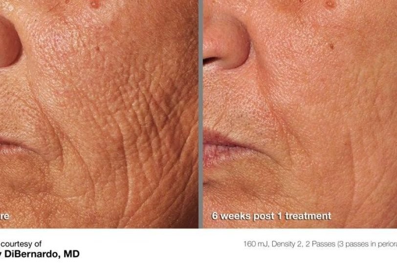 Anti-Aging Treatments