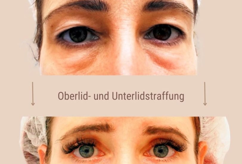Anti-Aging Treatments