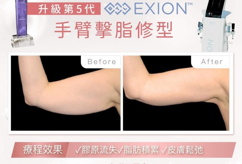 Body Contouring