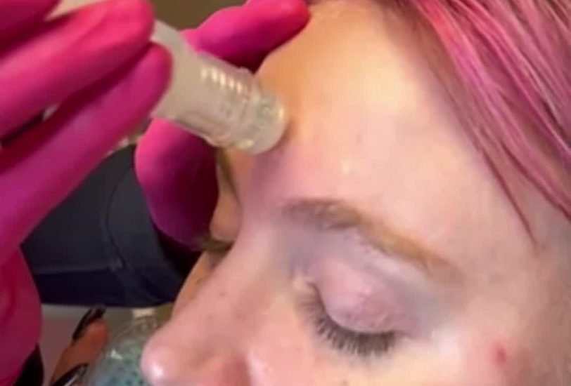 Pigmentation & Skin Tone Correction