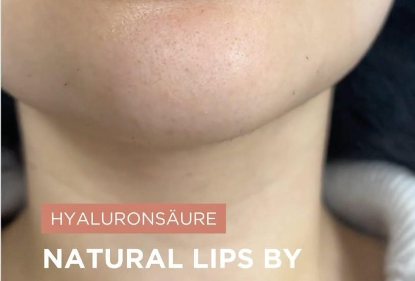 Lips Treatments