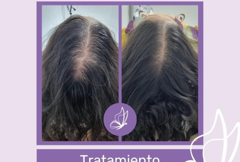 Hair Treatments